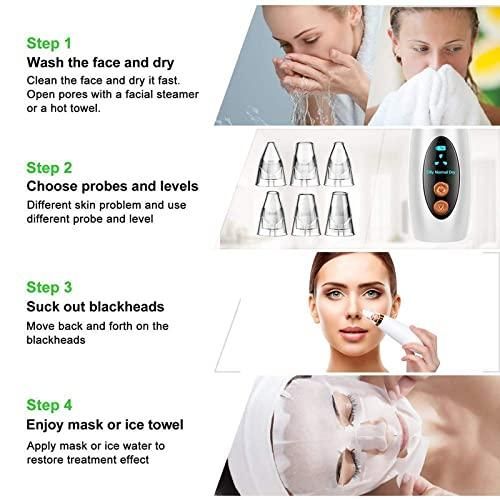 Remove Blackhead Device - TechLuxen